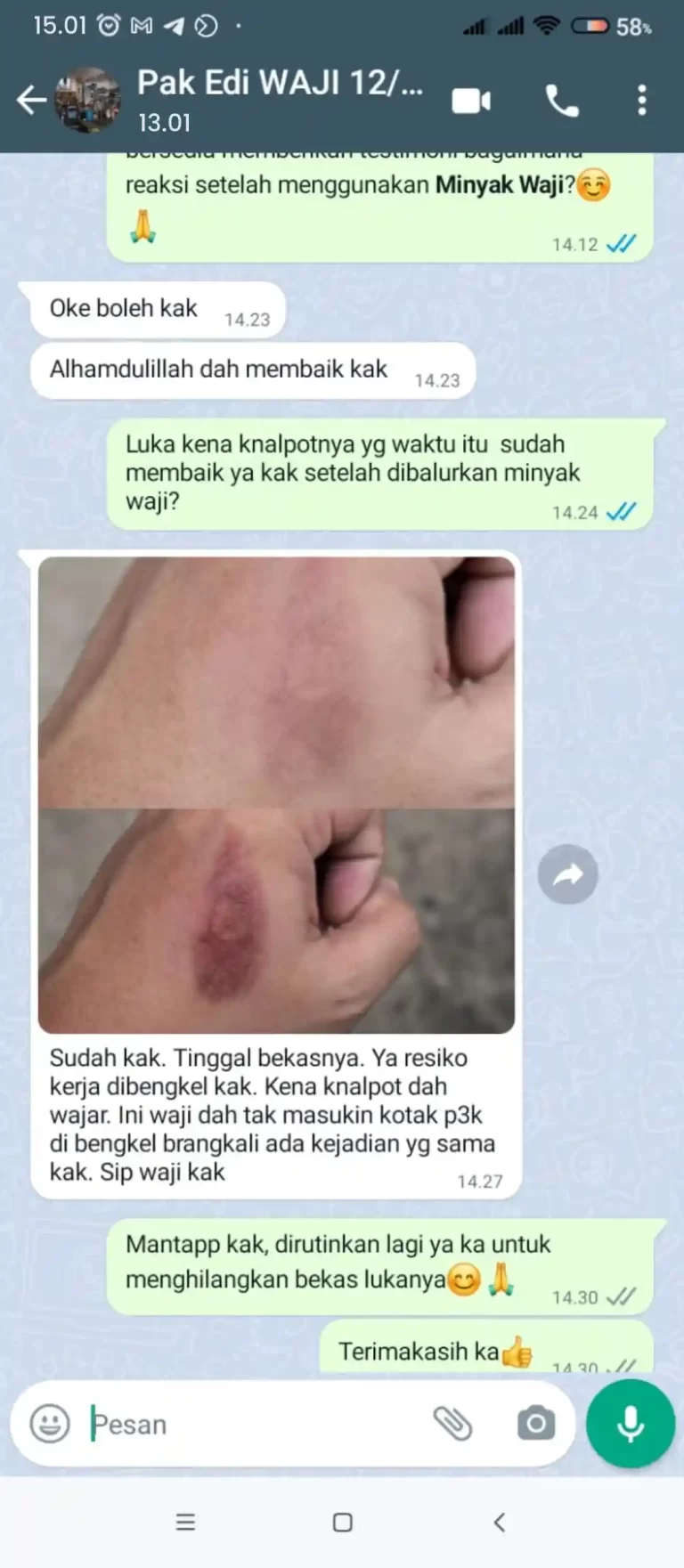 TESTI LUKA BAKAR