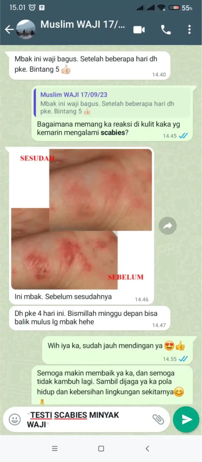 TESTI SCABIES